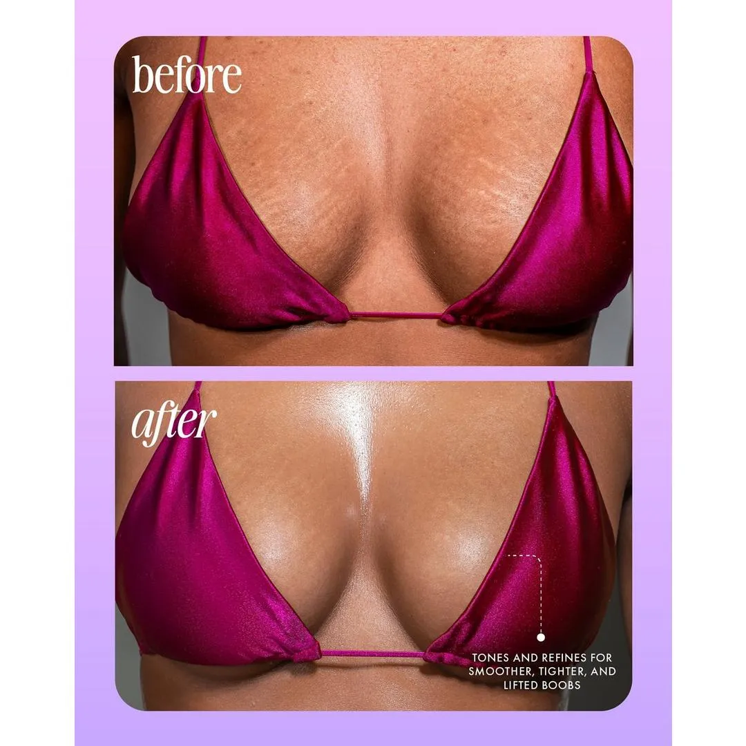 Truly Acai Your Boobies Set - Imagen 6